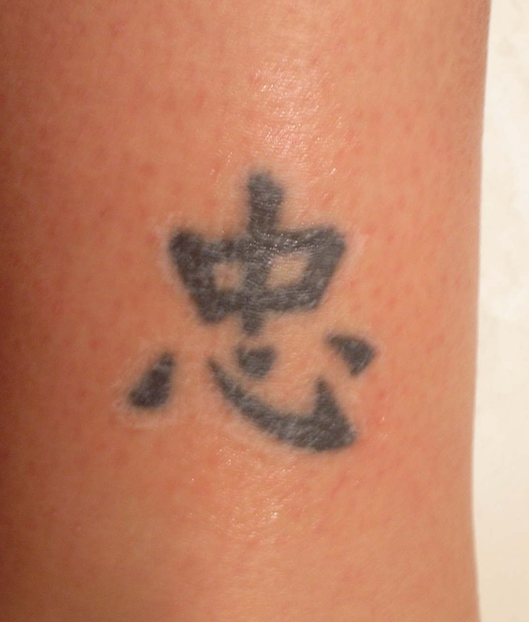 2nd Treatment, about 70% | Documenting TCA Tattoo Removal